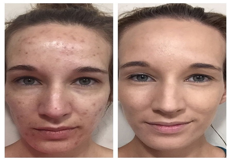 3 броя процедури за перманентен фон дьо тен BB Gwol в Nail & Relax Bar, София