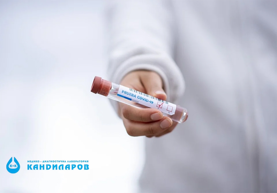 Бърз антиген тест за COVID 19 от Лаборатории Кандиларов
