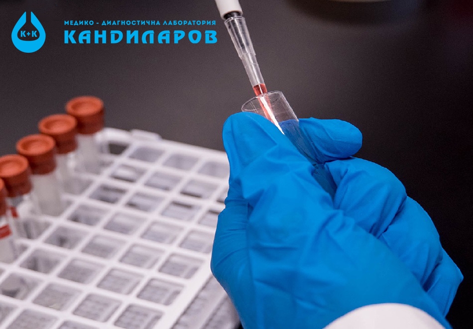 Изследване на нивото на инсулин в кръвта от Лаборатории Кандиларов