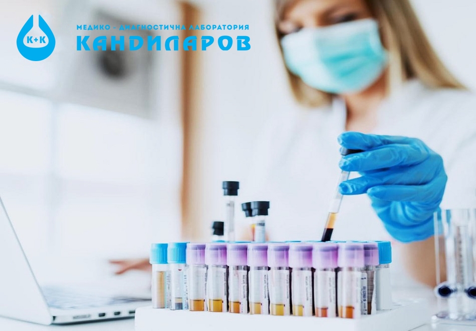 Кръвен тест за хранителна непоносимост към 44 храни плюс изследване за Candida albicans IgG от Лаборатории Кандиларов
